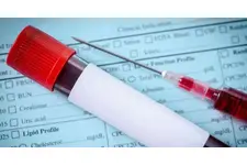 Ferritin Yüksekliği Nasıl Düşürülebilir? Ferritin Yüksekliği Nasıl Düşürülebilir?