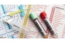 Kan Tahlili Ferritin Değeri