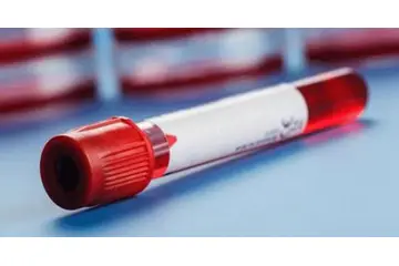 Ferritin Fazlalığı Belirtileri ve Tedavisi