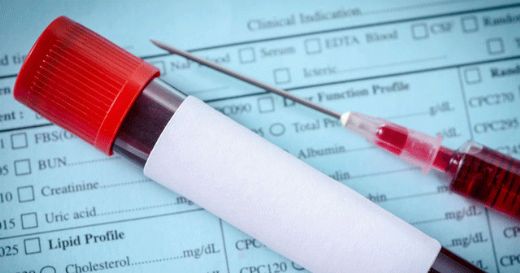 Ferritin Tahlil Nasıl Yapılır?